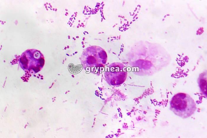 Phagocytes x600 - gryphea.org